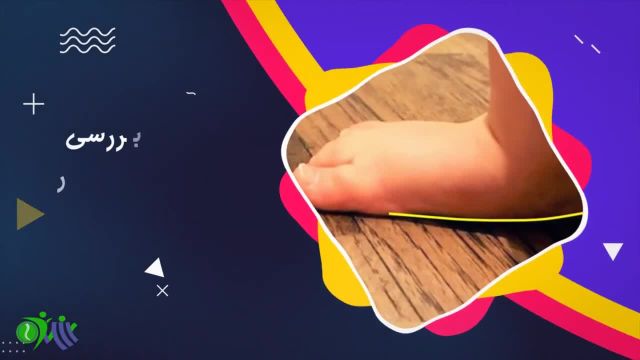 صافی کف پا در کودکان از تشخیص تا روش درمان آن