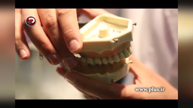 ارتودنسی نامرئی چیست؟ | دیگر با ارتودنسی دندان هایتان زشت نخواهید شد!