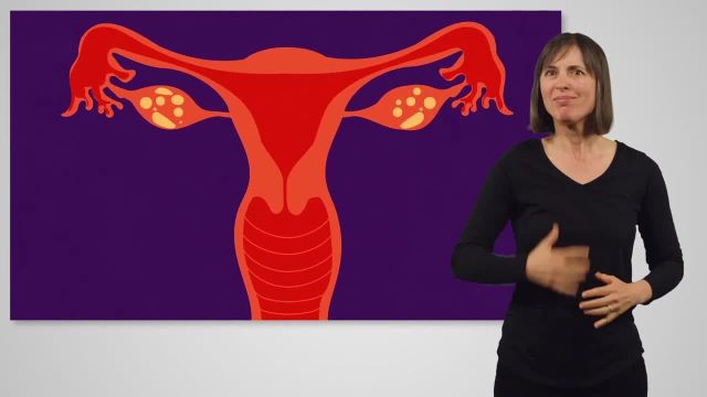 ویدئوی پیشگیری از بارداری در Auslan