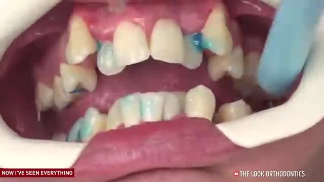 ارتودنسی دندان- دندانپزشکی اقساطی در مشهد
