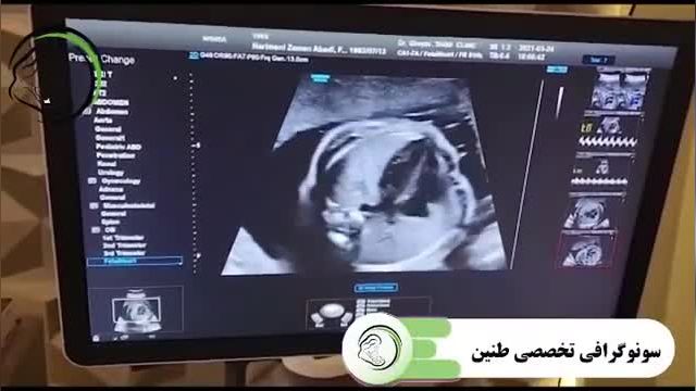 سونوگرافی تخصصی | اکوکاردیوگرافی جنین
