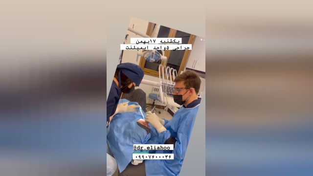 ایمپلنت دندان در مطب متخصص دکتر الیاهو