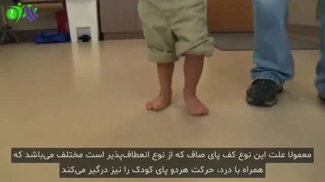 صافی پا در کودکان | درمان صافی کف پای کودکان را جدی بگیرید!