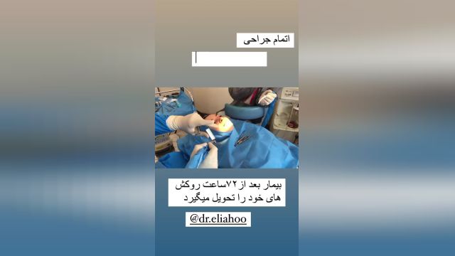 کاشت دندان فوری و ایمپلنت دندان در تهران