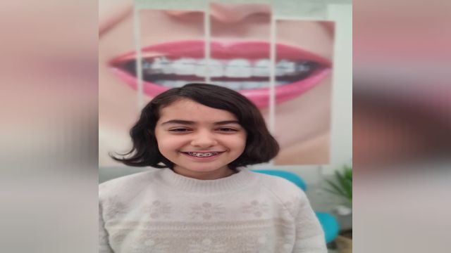 متخصص ارتودنسی کودکان در اصفهان | دکتر محمدعلی ناصری