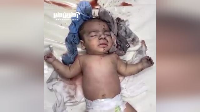 ویدئویی تکان دهنده از غزه؛ نوزاد فلسطینی، هدف حمله اشغالگران
