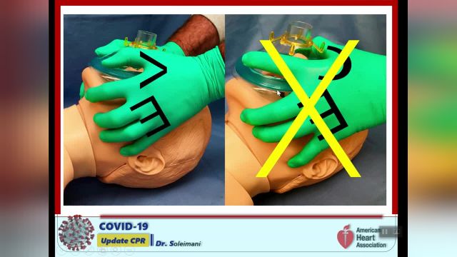 اصول مراقبت ویژه و احیاء قلبی ریوی (CPR) | ویدیو