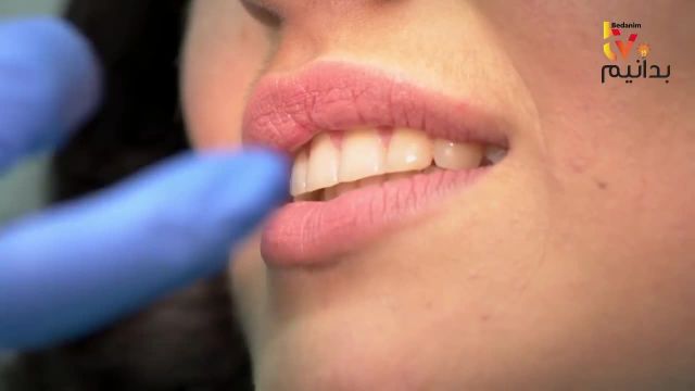 سفید کردن دندان در 5 دقیقه به روش خانگی بدون آسیب به مینای دندان!