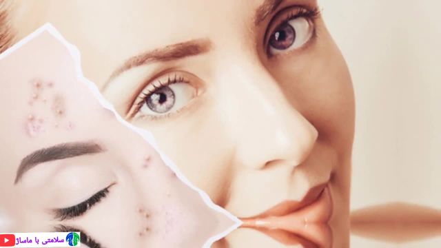 جوانسازی پوست | راز زیبایی پوست صورت و سلامت پوست