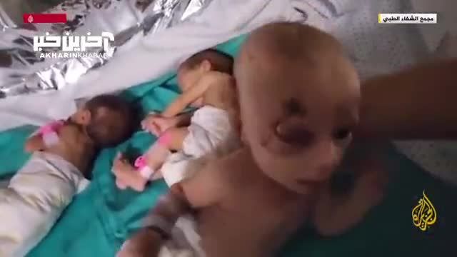 تصاویری از وضعیت نوزادان نارس در بیمارستان الشفاء غزه در اثر نبود اکسیژن و سوخت