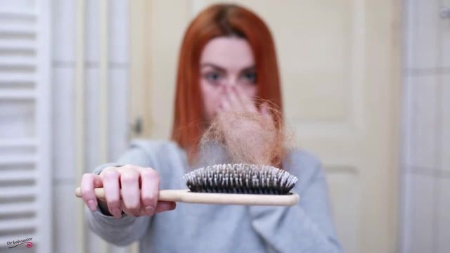 ریزش مو به علت کرونا | درمان ریزش مو پس از بهبودی کرونا در مردان و زنان