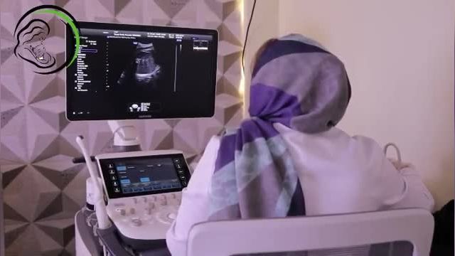 سونوگرافی سه ماهه سوم بارداری | در سونوگرافی سه ماهه سوم چه مواردی بررسی می شود؟