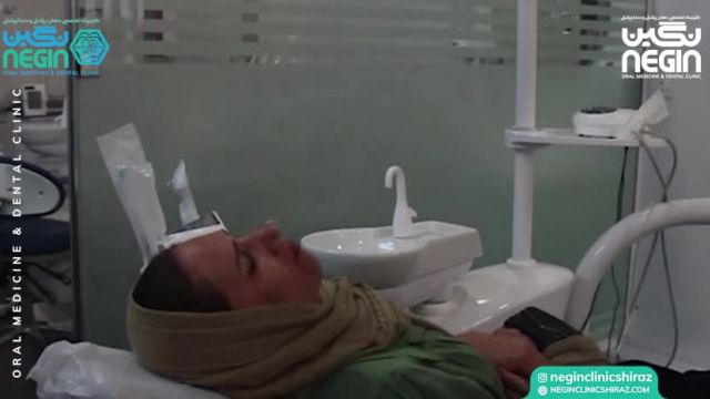 برداشتن ضایعه دهانی | کلینیک دهان پزشکی شیراز