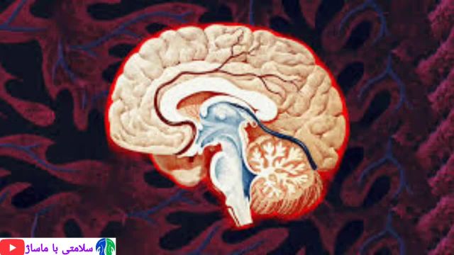 نزله مغزی چیست؟ | درمان نزله مغزی و بیماری‌های مغز