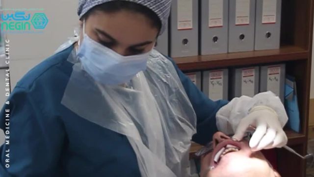 ترمیم کامپوزیت دندان | کلینیک دندانپزشکی در شیراز