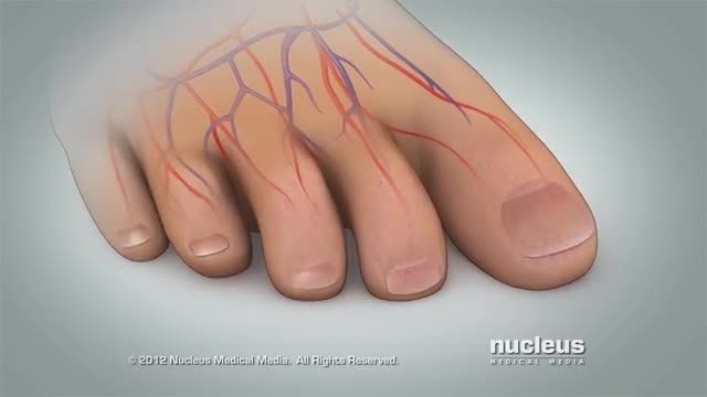 نحوه بررسی جریان خون در پای خود پس از جراحی | ویدیو