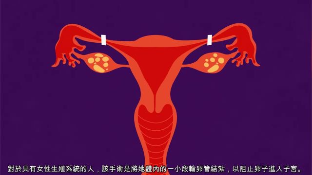 پیشگیری از بارداری در چین سنتی