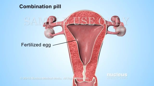 دانستنی های لازم در مورد قرص های ضد بارداری