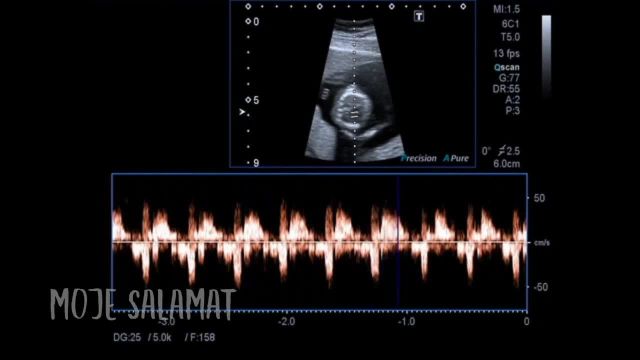 ویتامین های ضروری در دوران بارداری | ویدیو
