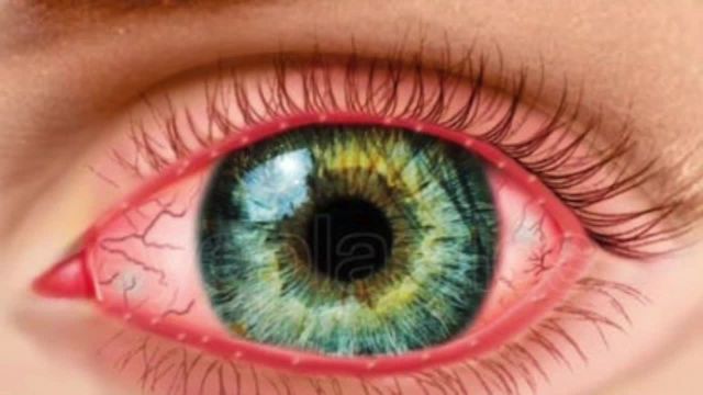 علت کاهش دید چشم چیست؟ | ویدیو