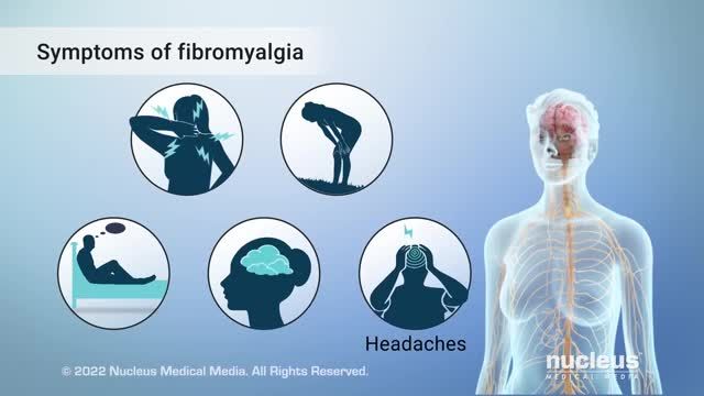 فیبرومیالژیا چیست؟ | ویدیو