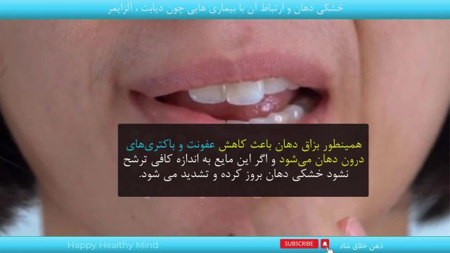 علت تشنگی زیاد و خشکی دهان | علل خشکی دهان و گلو در خواب