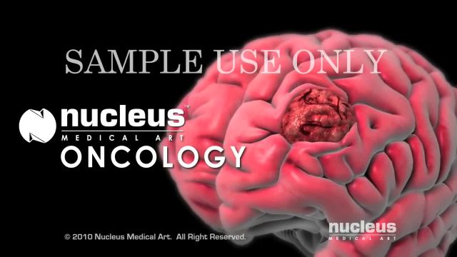 نسخه نمایشی انیمیشن Nucleus Oncology (2010)