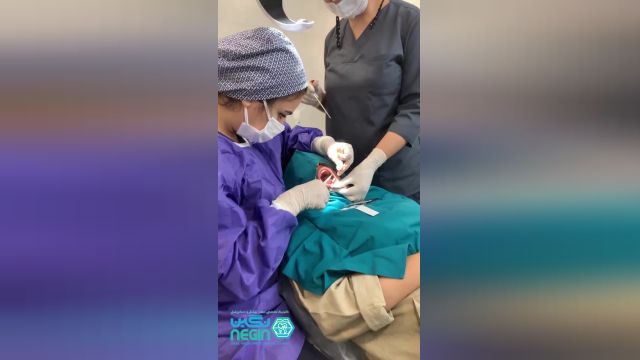 جراحی ایمپلنت دندان در شیراز | دکتر نگین اثنی عشری