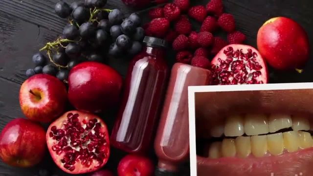 خراب شدن دندان | بعد از دیدن ویدیو هرگز این مواد غذایی را مصرف نمی کنید!