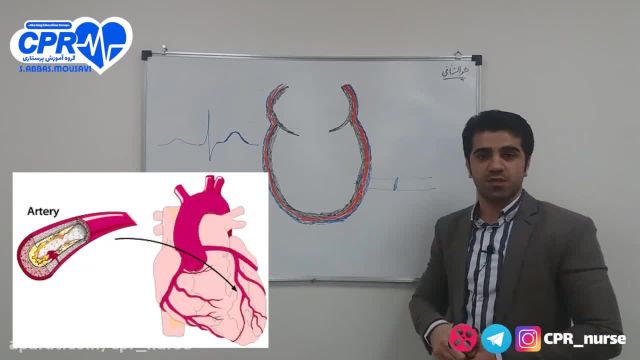آموزش کامل تفسیر نوار قلب ECG | بخش چهارم