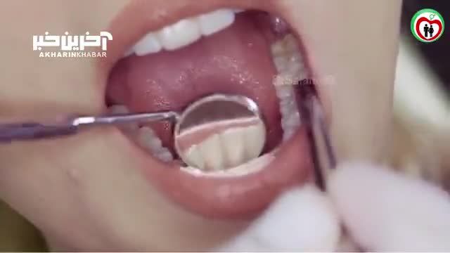 دانستنی های جالب در مورد دندان