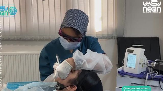 برداشتن ضایعه دهانی با لیزر | متخصص دهان پزشکی در شیراز
