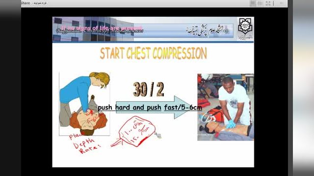 وبینار جامع و کامل احیاء قلبی ریوی پیشرفته | بروزترین نکات CPR