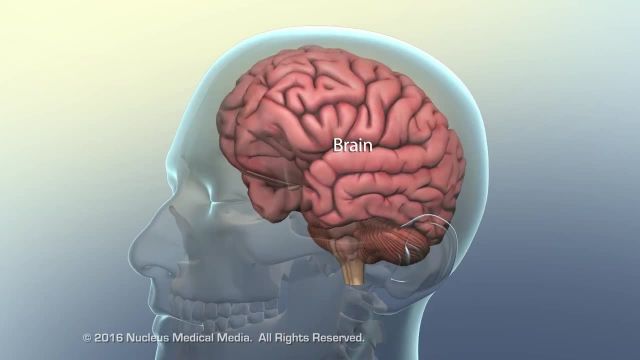 ضربه مغزی چیست و چه تاثیری بر مغز دارد؟