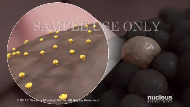 ایمونوتراپی سرطان | ویدیو