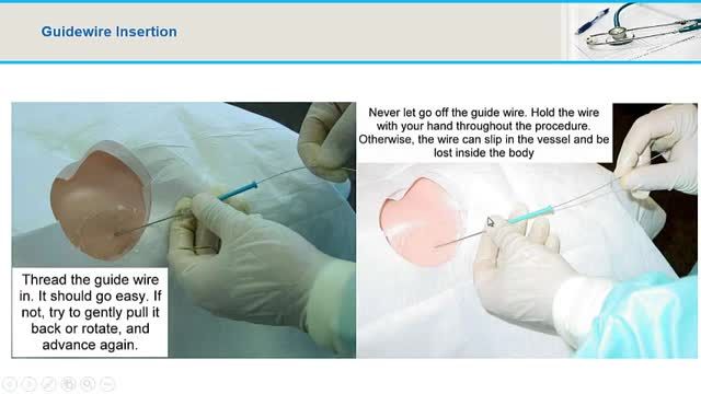 کتتر های ورید مرکزی (Central Venous Catheters) مخصوص متخصصین بیهوشی | بخش 2/2