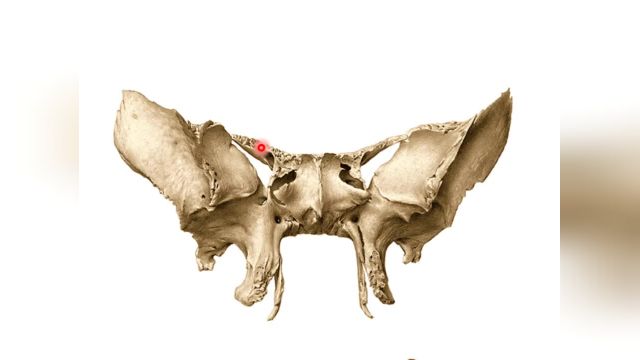 استخوان اسفنوئید | آموزش آناتومی مقطعی بدن | جلسه چهارم