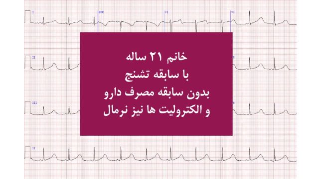 تمرین نوار قلب (الکتروکاردیوگرام) | بخش 1