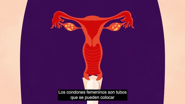 درباره پیشگیری از بارداری در اسپانیا