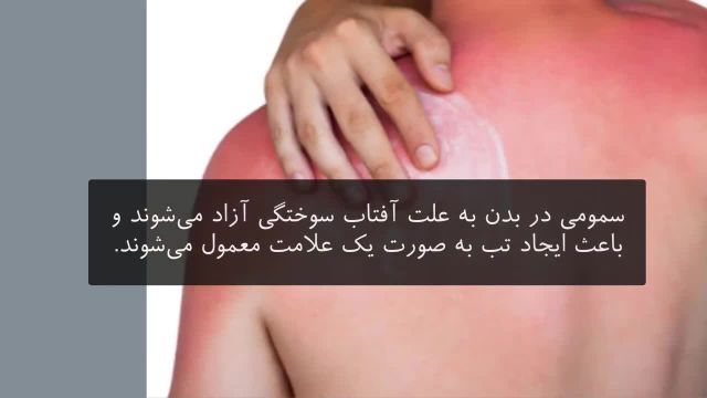 آفتاب سوختگی | درمان اساسی پوست آسیب دیده و تیرگی پوست ناشی از آفتاب سوختگی