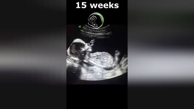 ویدئویی دیدنی از سونوگرافی از هفته 5 تا 38 بارداری