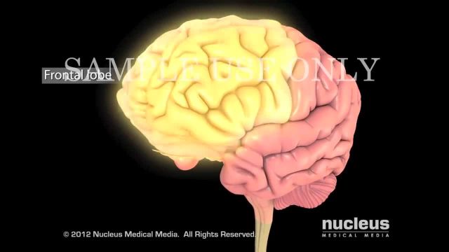 دانستنی های لازم در مورد  ضربه مغزی (TBI)