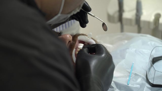 نحوه انجام لمینت دندان مراجعه کننده محترم در کلینیک دندانپزشکی بارانا