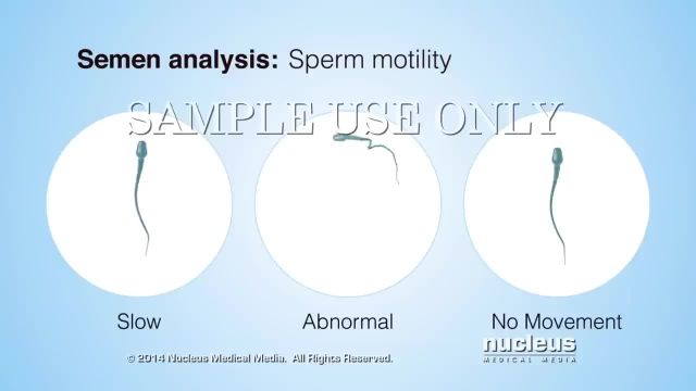 دانستنی های لازم در مورد تعداد اسپرم