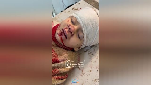 دردناک‌ترین ویدیو: مجروحیت شدید یک کودک فلسطینی در خان یونس