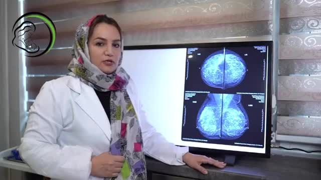 اهمیت ماموگرافی | چرا باید ماموگرافی انجام بدیم؟