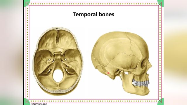 استخوان تمپورال | آموزش آناتومی مقطعی بدن | جلسه ششم