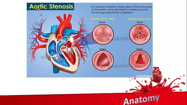 آناتومی قلب | آموزش علوم تشریح (آناتومی) قلب و عروق | جلسه اول (6)