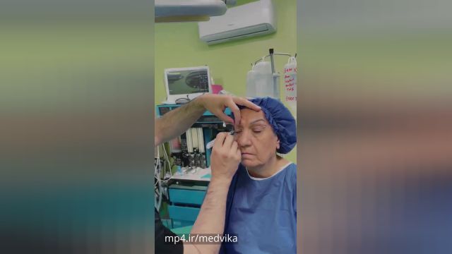 چرا چشم بعد از جراحی پلک کوچک می شود؟
