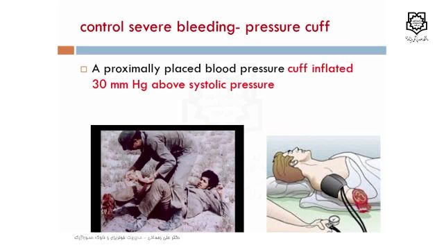 ویدئو مدیریت خونریزی و شوک هموراژیک | علوم پزشکی بقیه الله